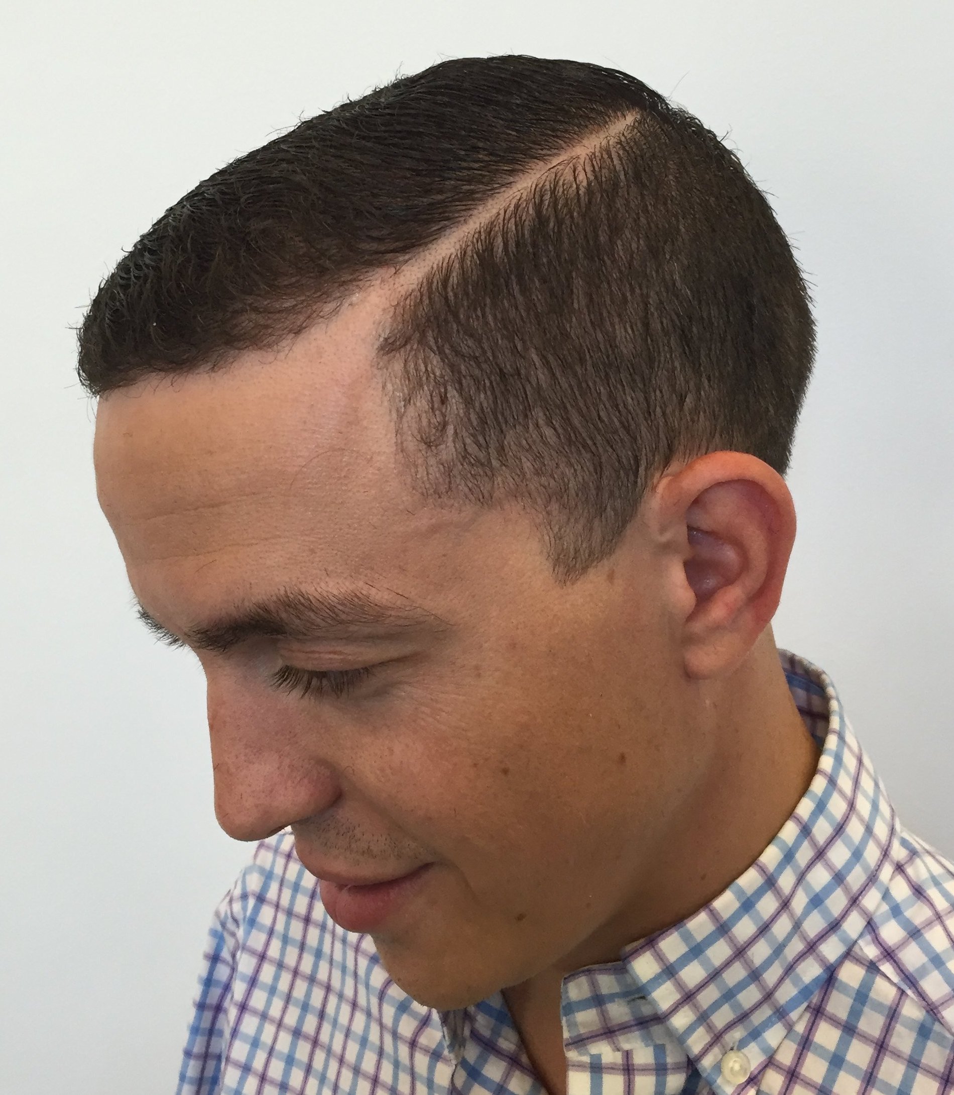 Shaved Part